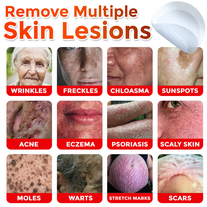 🌈Solvantar MicroNeedle Botanic Skin Tag Removal Patch 🇺🇸 Made in the USA