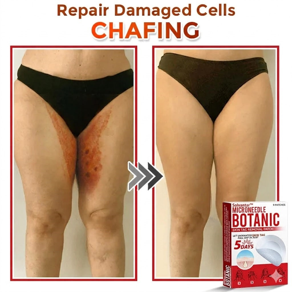 🌈Solvantar MicroNeedle Botanic Skin Tag Removal Patch 🇺🇸 Made in the USA