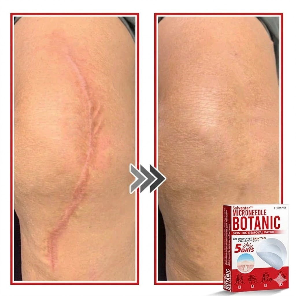 🌈Solvantar MicroNeedle Botanic Skin Tag Removal Patch 🇺🇸 Made in the USA