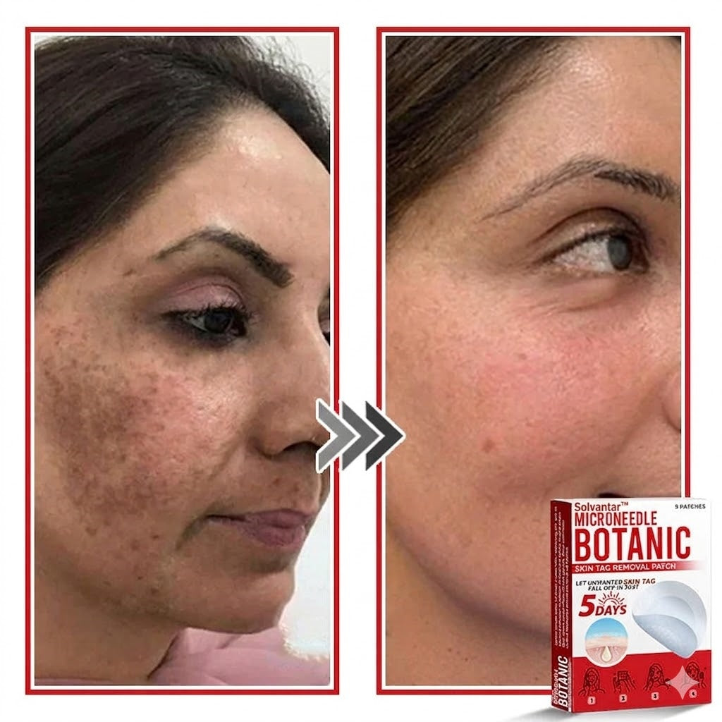 🌈Solvantar MicroNeedle Botanic Skin Tag Removal Patch 🇺🇸 Made in the USA